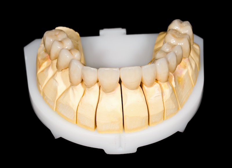Dentalna klinika Igor Radusinović - Dobrodošli v dentalni kliniki, kjer poskrbimo za zdravje vaših zob in nasmeh. 071 555 444 • narocanje@denti.si