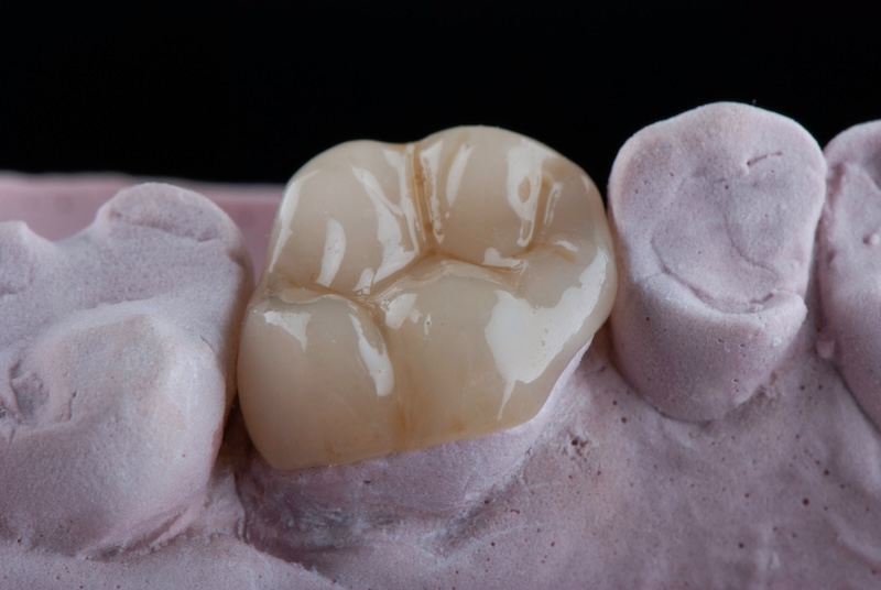 Dentalna klinika Igor Radusinović - Dobrodošli v dentalni kliniki, kjer poskrbimo za zdravje vaših zob in nasmeh. 071 555 444 • narocanje@denti.si