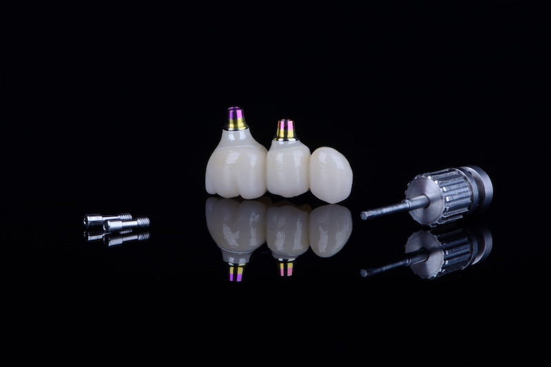 Dentalna klinika Igor Radusinović - Dobrodošli v dentalni kliniki, kjer poskrbimo za zdravje vaših zob in nasmeh. 071 555 444 • narocanje@denti.si