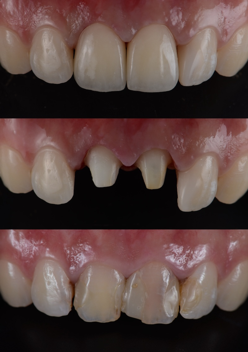 Dentalna klinika Igor Radusinović - Dobrodošli v dentalni kliniki, kjer poskrbimo za zdravje vaših zob in nasmeh. 071 555 444 • narocanje@denti.si