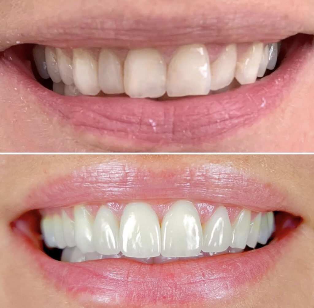 Dentalna klinika dr. Igor Radusinović - Dobrodošli v dentalni kliniki, kjer poskrbimo za zdravje vaših zob in nasmeh. 071 555 444 • narocanje@denti.si